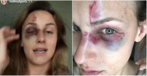 Brasileiro acusado de espancar namorada é preso nos EUA