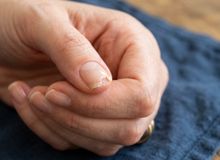 Featured side: A unha lasca sempre no mesmo canto e isso pode ter mais relação com a rotina das mãos do que com o esmalte usado