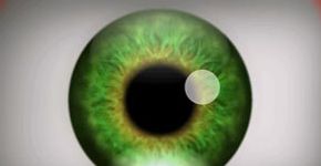 Você sabia que é possível ter alucinações visuais sem ingerir substâncias lisérgicas?