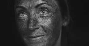 Documentarista mostra estragos que o sol faz na pele