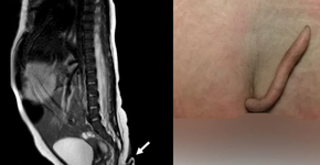 Foto: (reprodução/Journal of Pediatric Surgery Case Reports)