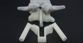 Empresa usa impressão 3D para modelagem de órgãos humanos