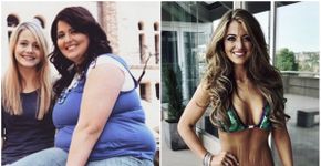 Mulher perde 60 kg e ganha competição mostrando suas estrias com orgulho