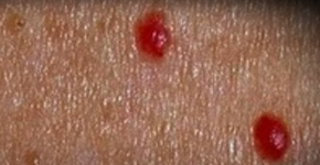 Foto: (reprodução/youtube/Medicina Television)