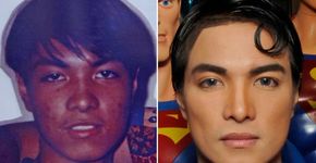 Filipino faz 23 cirurgias para ficar parecido com o Super-Homem