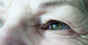 Foto: (iStock/Zanuck)