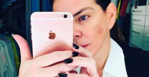 Gisele Fraga revela que foi vítima de agressão por ex-companheiro