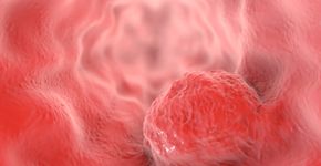 Foto: (Dr_Microbe/istock)