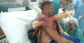 Homem cai de asa-delta e fica com tronco de árvore preso no braço