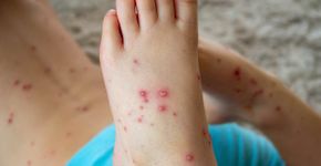 Foto: (Povorozniuk Liudmyla/istock)