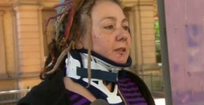 Mulher é salva pelos dreadlocks ao ser atacada a machadadas