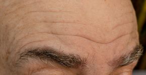 Foto: (Iryna Dobytchina/istock)