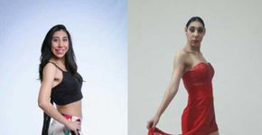 Jovem com microcefalia persegue sonho de desfilar como modelo