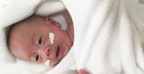 Menor bebê prematuro do mundo completa 9 meses; veja como está