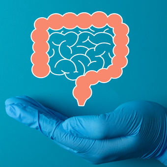 Featured mobile: Câncer de intestino: entenda o papel da colonoscopia na identificação precoce da doença