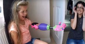 Menina ganha prótese 3D feita por esportista deficiente