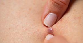 Foto: (Ocskaymark/istock)