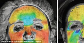 Foto: (© Perelman School of Medicine/UPenn)