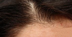 Foto: (ArveBettum/istock)