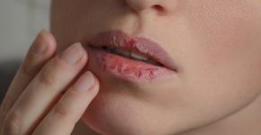 Foto: (Tetiana Mandziuk/istock)