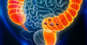 Foto: (iStock/libre de droit)