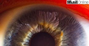 Professor de física faz fotos impressionantes de olhos humanos