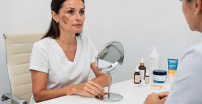 Quanto custa o tratamento de melasma nas clínicas mais modernas do Brasil?