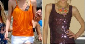 Ex-anoréxica ganha 32 kg ao se tornar fisiculturista