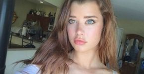 Fotos mostram pessoas e animais com olhos de cores diferentes