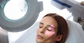 O que causa vasinhos no rosto? 8 motivos que afetam a estética