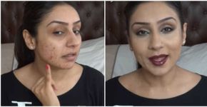 6 tutoriais de maquiagem para quem sofre com problemas de acne