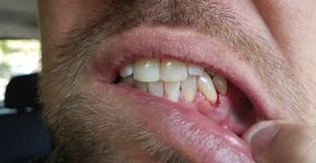 Foto: (:Justin Smith/istock)