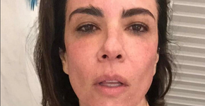 Luciana Gimenez publica foto durante exame de mamografia