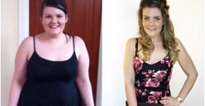 Chocólatra perde 44 quilos ao eliminar doces de sua dieta