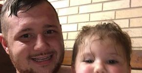 Pai faz tatuagem que imita a queimadura da filha de dois anos