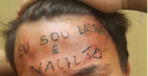 Jovem tatuado à força na testa ganha cirurgia para remoção