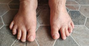 Foto: (iStock/Rungrudee)