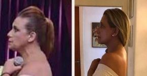 Rita Cadillac posta ‘antes e depois’ de tratamento no Instagram