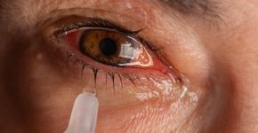 Foto: (iStock/turk_stock_photographer)