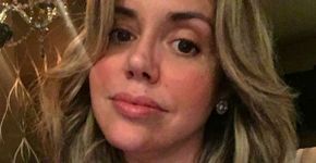 Renata Banhara revela novos detalhes da agressão que sofreu do ex
