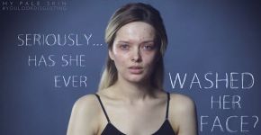 Blogueira com acne contra-ataca bullying em vídeo viral