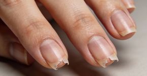 Quem tem unhas descamando precisa conhecer esse cronograma matador de três minutos