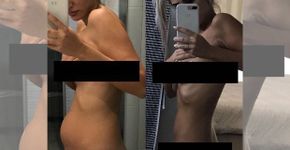 Mulher mostra o efeito da endometriose em seu corpo
