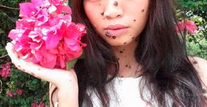Jovem malaia mostra como passou a aceitar as suas pintas