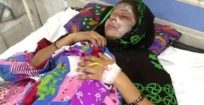 Homem joga ácido em esposa após ter mais uma filha mulher