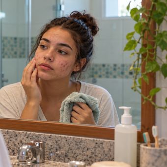 Featured mobile: Pele cheia de espinhas? Dermatologistas destacam um hábito diário que muitos jovens acabam deixando de lado