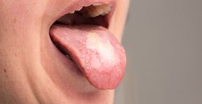 Foto: (sruilk/DepositPhotos)