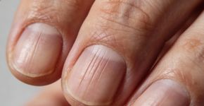 Unhas listradas: o que significam e o que expressam sobre a pessoa que as usa