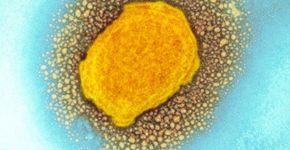 Foto: (Science Photo Library)