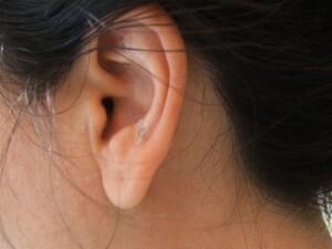 Auriculoterapia é um tratamento reflexológico por meio de estímulos no pavilhão auricular